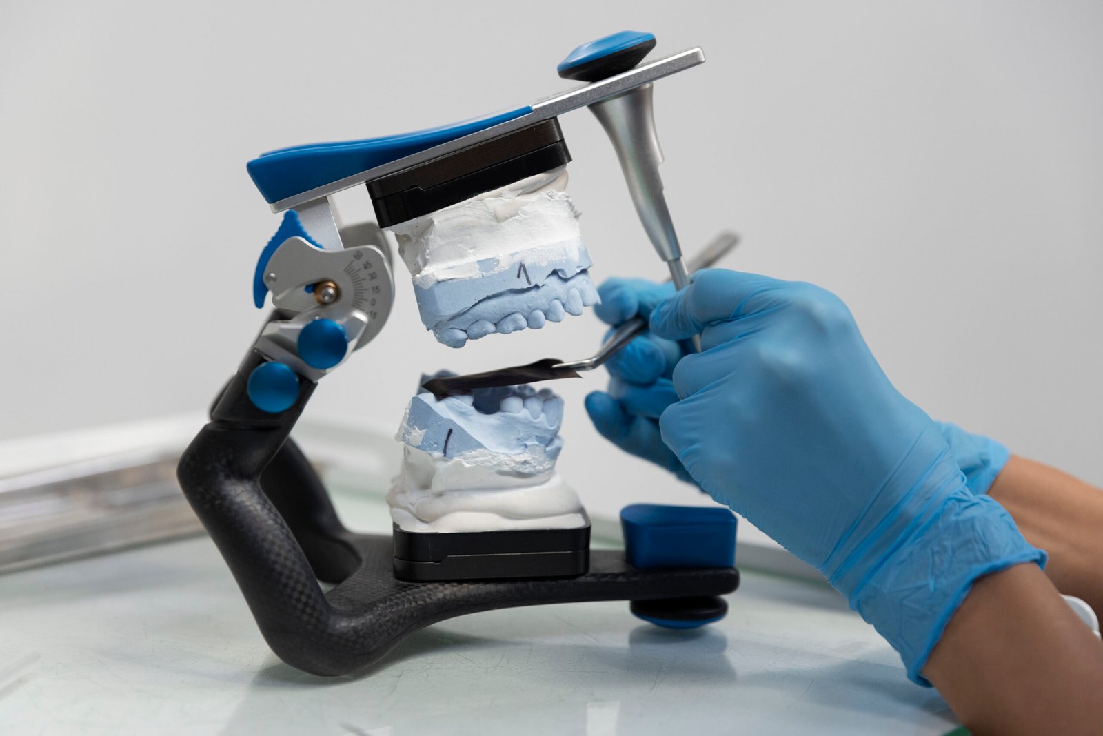 impresión 3D en prótesis dentales